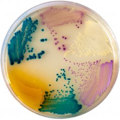 MELAB Chromogenic Orientaion Agar