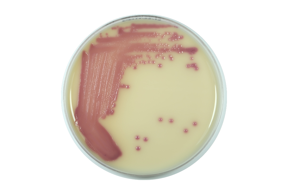 MELAB Chromogenic UTI Agar