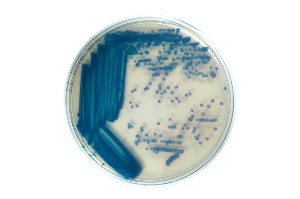 MELAB Chromogenic Strepto B Agar